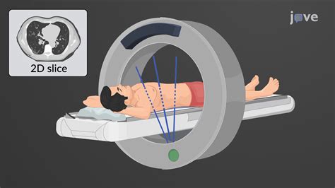 Computed Tomography | Anatomy and Physiology | JoVe