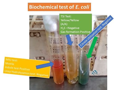 Biochemical test of E. coli: Introduction, Pathogenic strains and ...