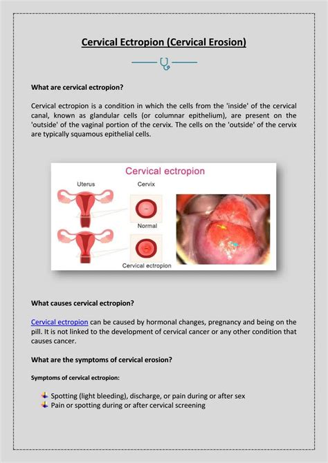 What are Cervical Ectropion? by ankurfertility - Issuu