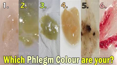 What does my phlegm color mean – The Meaning Of Color