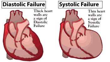 Phimaimedicine: 889. Diastolic heart failure