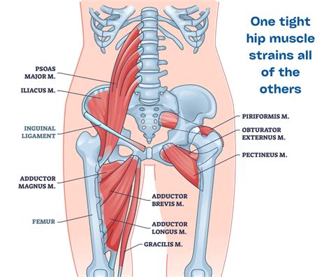 Hip Flexor Pain Causes