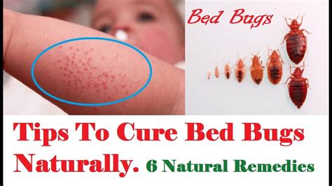 Tips To Cure Bed Bugs Naturally ¦ 6 #Natural Remedies - YouTube