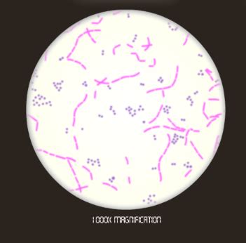 The Gram Stain | Theory & Procedure - Video & Lesson Transcript | Study.com