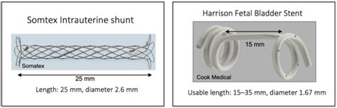 Shunt types used for thoracoamniotic shunting. | Download Scientific ...