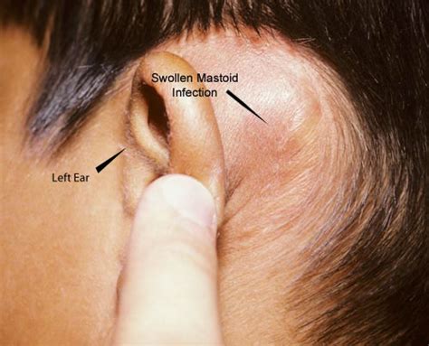 Hurts Behind Left Ear: Causes and Treatments