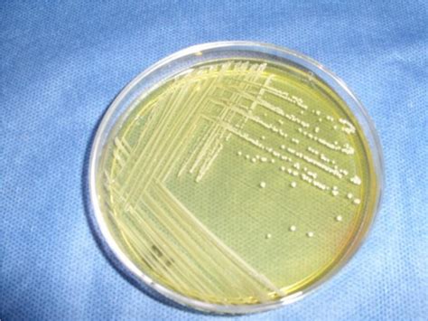 Staphylococcus aureus small colony variants with pinpoint form in ...