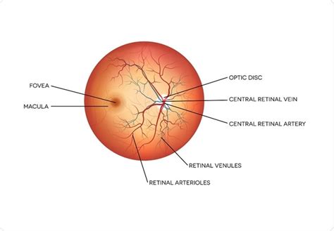 Optic Disc Swelling: Overview