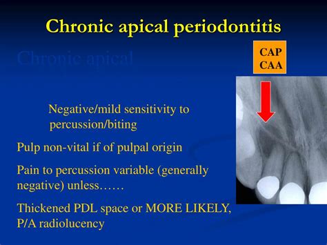 Apical Periodontitis Vs Apical Abscess