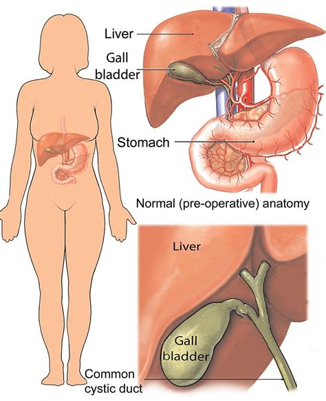 Gallbladder Pain Location Diagram - General Wiring Diagram