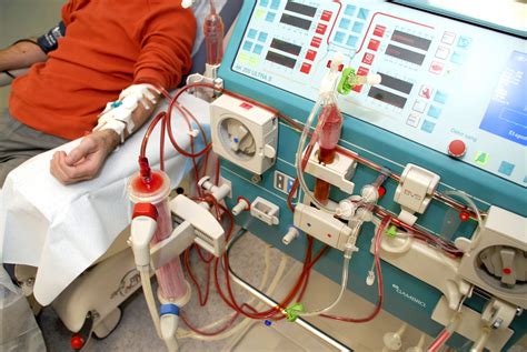 Do You Continue to Make Urine After Starting Dialysis?