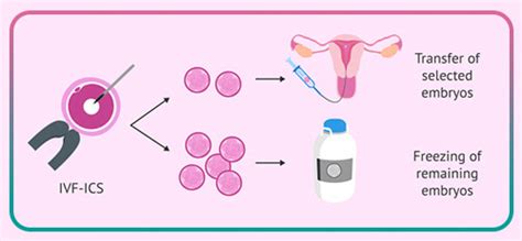 Frozen Embryo Transfer: Advice and Cares | HayatMedTour