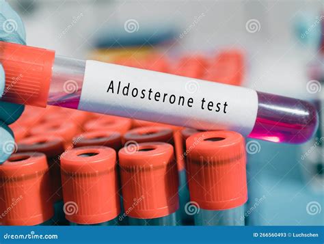 Aldosterone Hormone Test Regulates Salt, Water Balance, and Blood ...