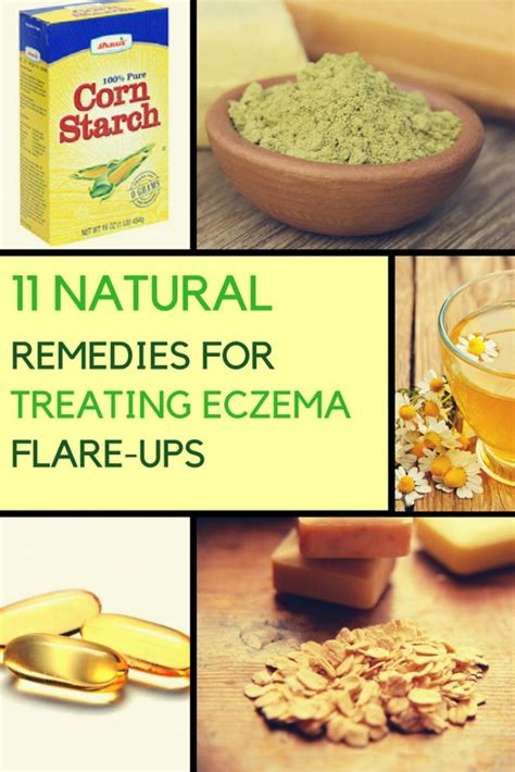 Natural Remedies for Eczema: 11 of Them That Really Work | Natural ...