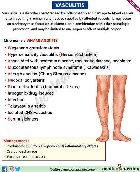 Vasculitis Symptoms