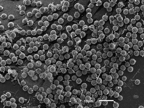 Puffball Spores - Lichen Labs