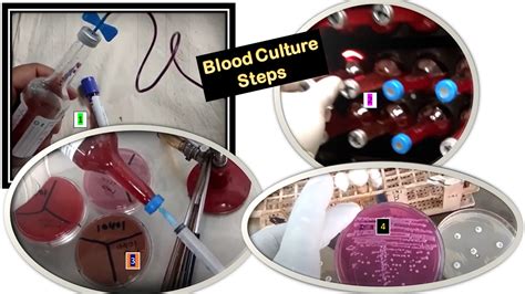 Blood Culture: Introduction, Test Requirements, Procedure, Result-Interp