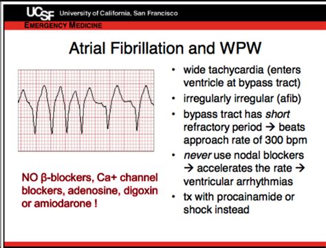 Afib With Rvr Treatment