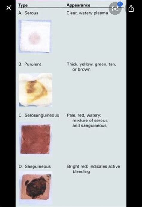 Types of wound drainage | Nursing school survival, Home health nurse ...