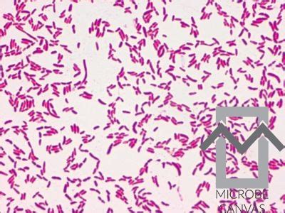 Pseudomonas Aeruginosa Gram Stain