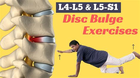 How do you stretch a bulging disc in your lower back? - Health Blog