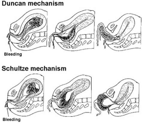 2.11 Third Stage of Labor - Obstetric and Newborn Care II