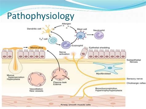 Pathophysiology Of Bronchial Asthma / Asthma For Nurses - Asthma Lung ...