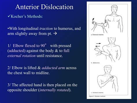 PPT - Shoulder Dislocation PowerPoint Presentation - ID:4841498