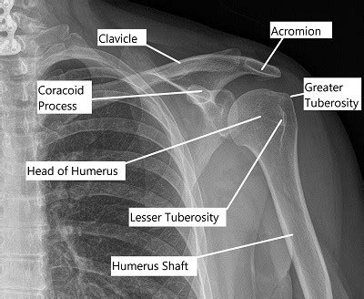 Shoulder Anatomy - Complete Orthopedics & Podiatry | Multiple NY Locations