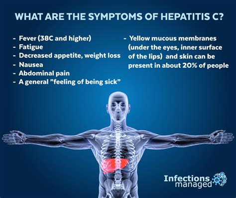 What are the symptoms of hepatitis C? | Infections Managed