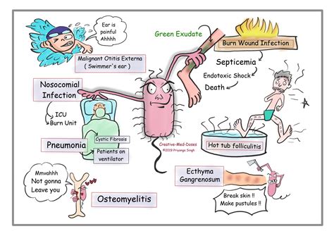 Pseudomonas Aeruginosa Burn Infection