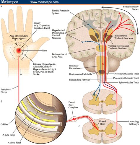 Acute vs Chronic Pain