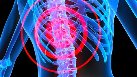 The Most Common Symptoms of Spinal Cord Injury – Lets Blog Health