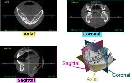 Axial, coronal and sagittal view | Download Scientific Diagram