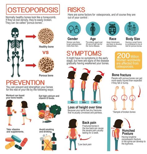 Osteoporosis Treatment in Jackson & Madison, MS