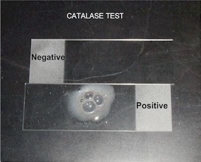 CATALASE TEST PROCEDURE - Microbiology Lab Notes