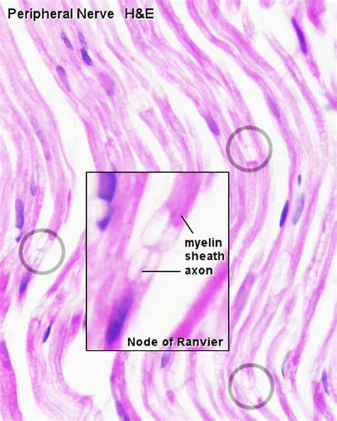 File:Peripheral nerve histology 03.jpg - Embryology