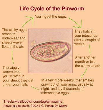 How to Treat Pinworms: Your Most Common Questions Answered | How to ...