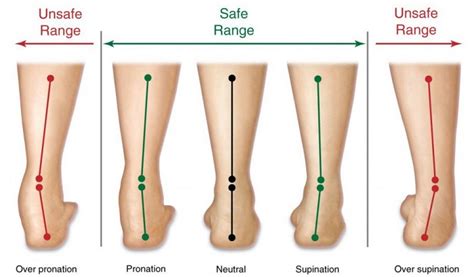 What's Underpronation? Working Pronation Defined - Information treasure