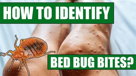 How To Identify Bed Bug Bites - Can Doctors or Exterminators Identify ...