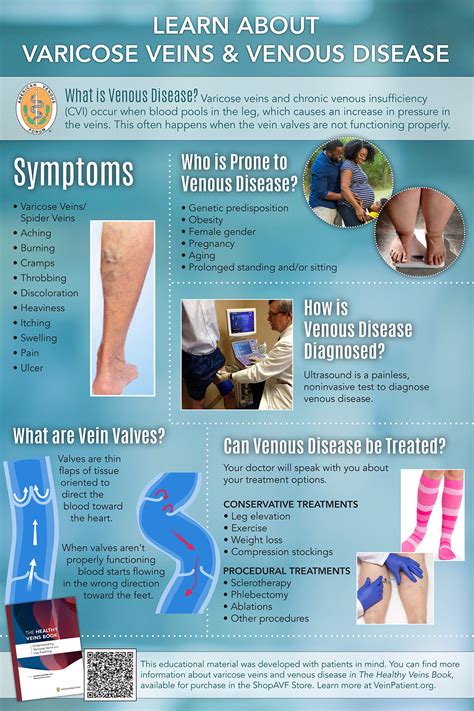 Chronic Venous Insufficiency: Causes, Symptoms And, 53% OFF