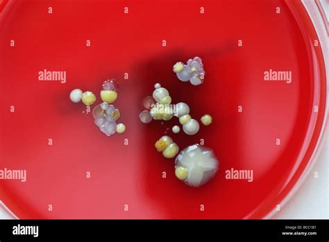 Petri dishes containing colonies of Staphylococcus Epidermidis ...