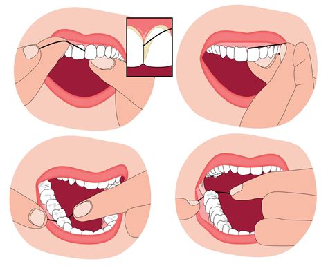 You're Doing It Wrong! How to Floss the Right Way