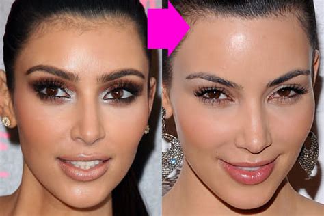 Kim Kardashian Laser Hair Removal Before And After Pictures