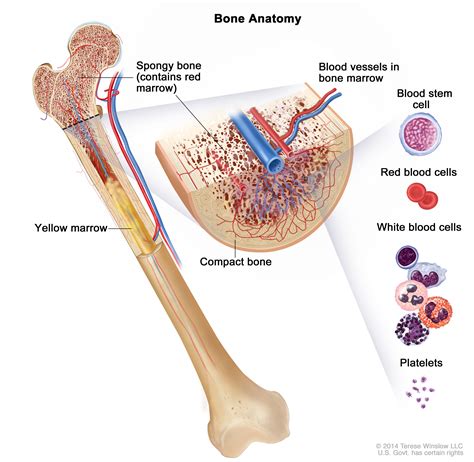 Acute Myeloid Leukemia Treatment - NCI