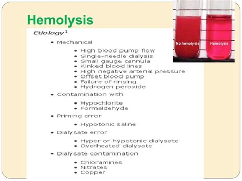 Hemodialysis complications