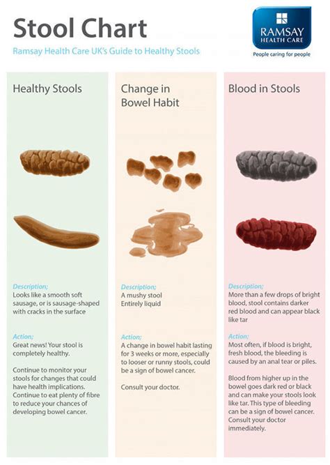 What Does Colon Cancer Poop Look Like Pictures - PictureMeta