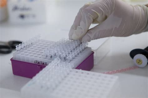 What can genetic tests tell us about dementia risk? | Alzheimer's Society