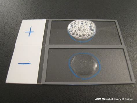 Catalase test (Principle, Procedure, Result interpretation and ...