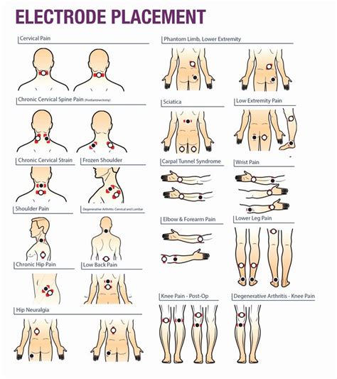 Electrode Pad Placement Chart Elegant Tens Unit Pads Google Search ...